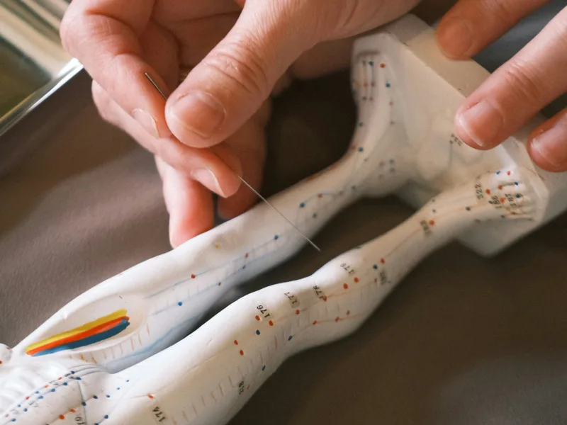 Acupuncture at Wellcare Chiropractic And Rehabilitation Clinic in houston