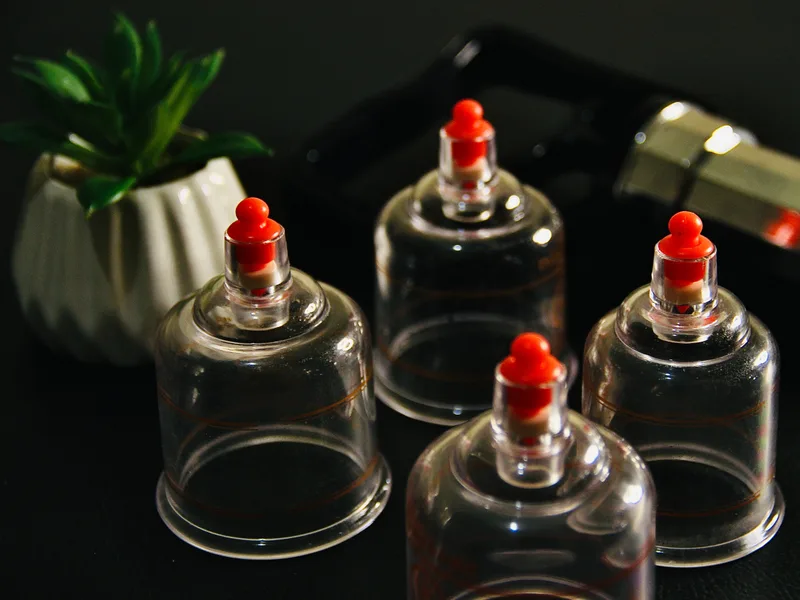 How Cupping Therapy works at Wellcare Chiropractic And Rehabilitation Clinic