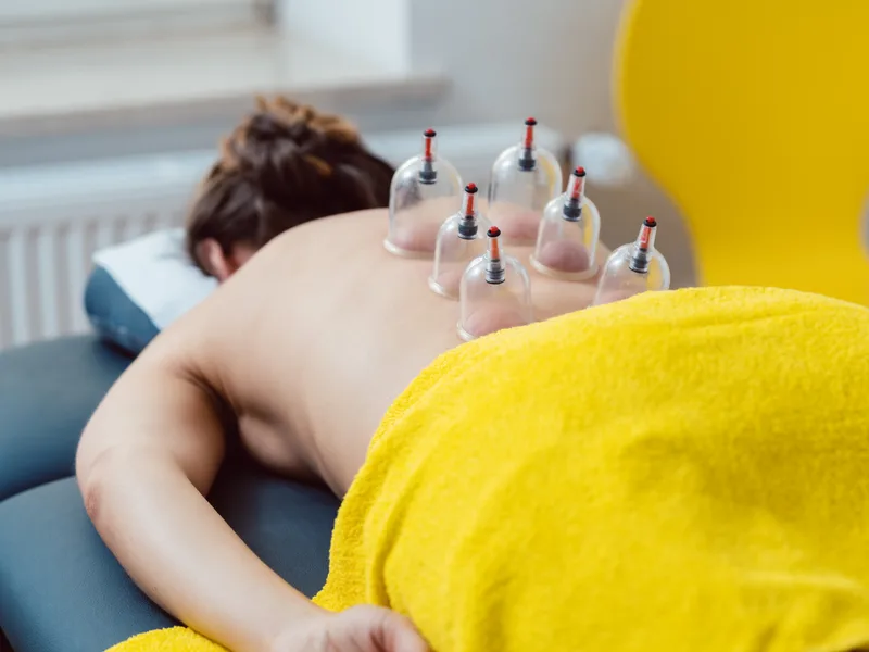 Cupping Therapy at Wellcare Chiropractic And Rehabilitation Clinic in houston