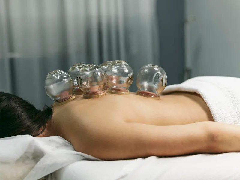 Cupping Therapy at Wellcare Chiropractic And Rehabilitation Clinic in houston