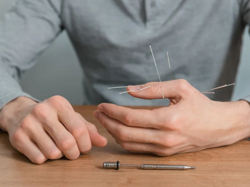 Dry Needling at Wellcare Chiropractic And Rehabilitation Clinic in houston