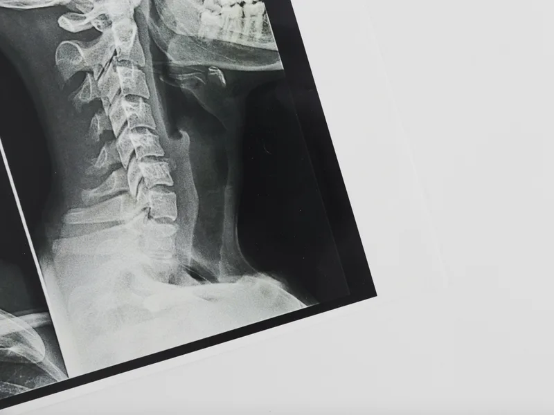 X-Rays at Wellcare Chiropractic And Rehabilitation Clinic in houston