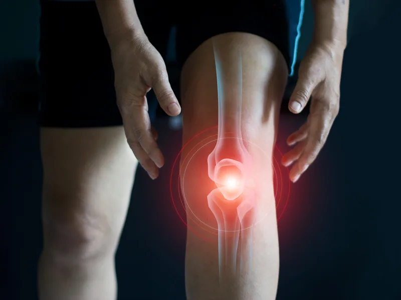 How Wellcare Chiropractic And Rehabilitation Clinic treats arthritis in houston